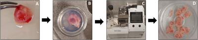 Human precision-cut cystic duct and gallbladder slices: a novel method for studying cholangiopathies